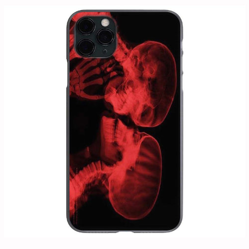 Kiss of Death Phone Case for iPhone 7 8 X XS XR SE 11 12 13 14 Pro Max Mini Note 10 20 s10 s10s s20 s21 20 Plus Ultra